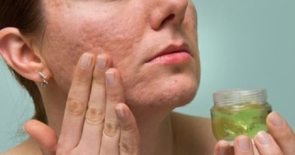 cannabis skin cream